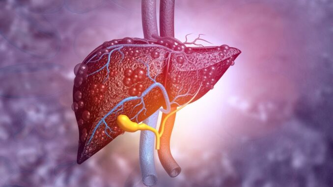 Kemenkes Temukan 15 Kasus Suspek Hepatitis Akut