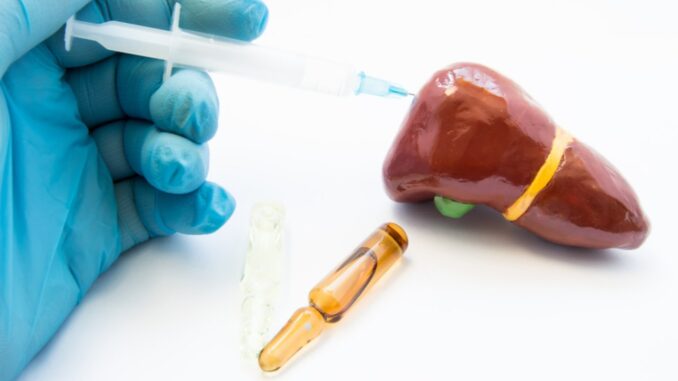 Hepatitis Akut Karena Vaksin Covid-19