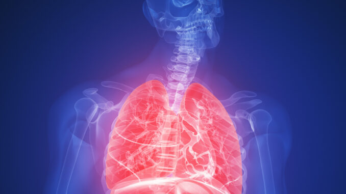 Waspadai Penyebab dan Gejala Infeksi Paru Yang Diderita Menpan RB Tjahjo Kumolo