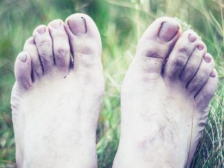 Pendaki Hipotermia meninggal di gunung slamet